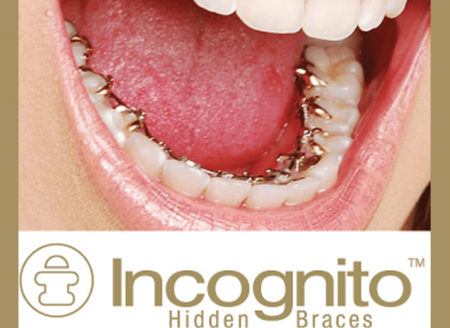 Incognito-Braces Dr Bichra Marrakech Maroc 02.jpeg