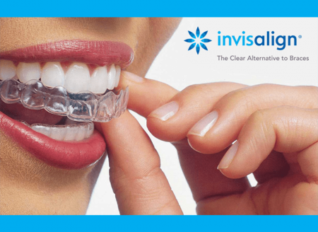 invisalign Marrakeche Centre Orthodontie Bichra Marocpng